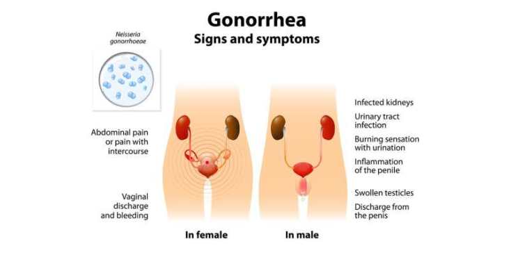 Which drugs can cure gonorrhea?